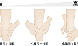 居家护理全攻略：肿瘤患者合并肌少症的诊断与综合管理 | 直播回顾